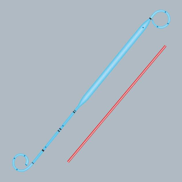 Endopyelotomy Stent