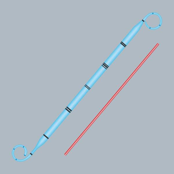 allSoft Tumor Stents