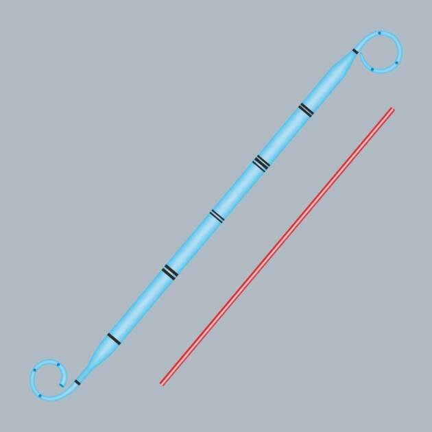 allSoft Tumor Stents